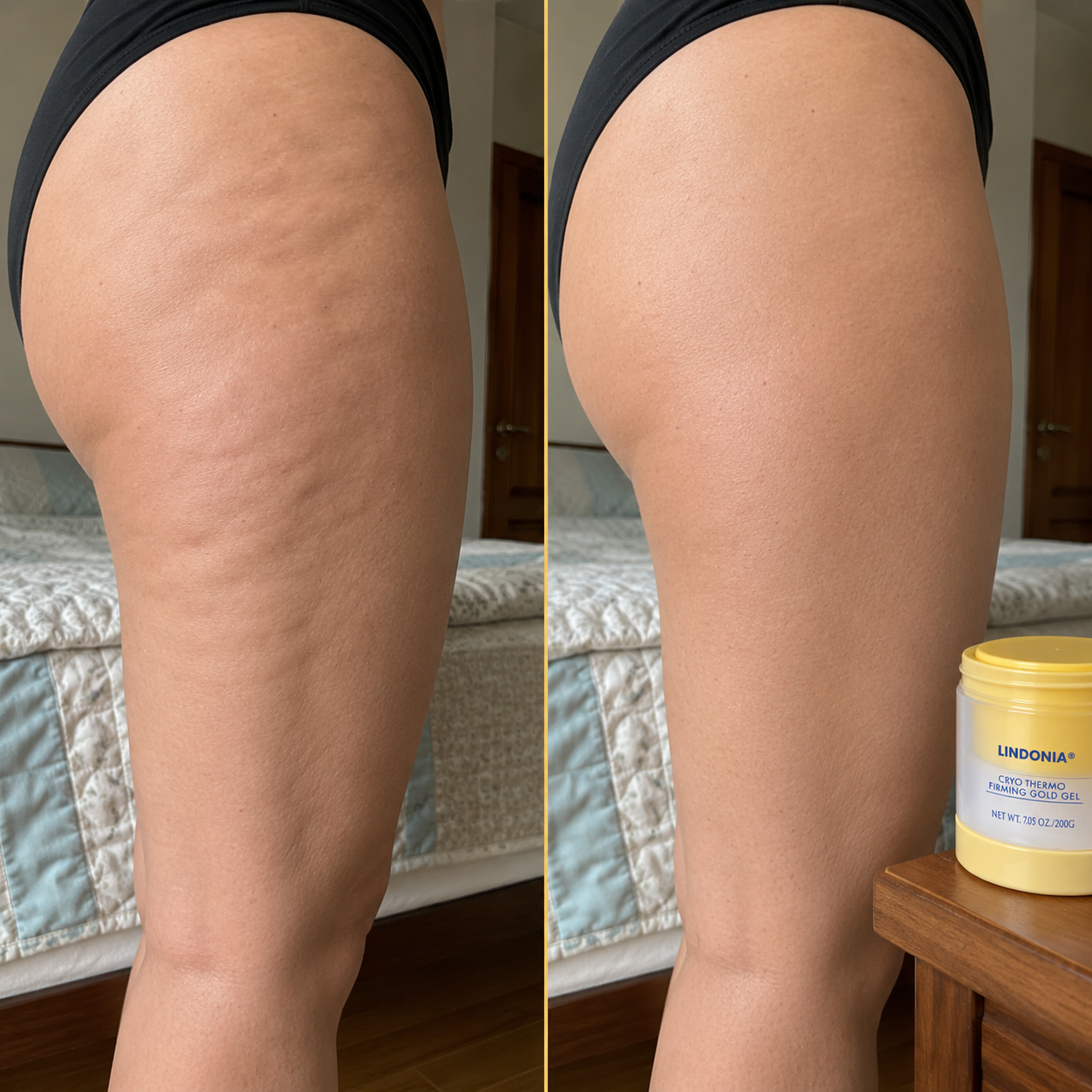 Lindonia® Gold Gel Anticelulitis